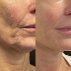 Anti-aging serum stick with bee venom and triple peptide complex, 30ml firming formula