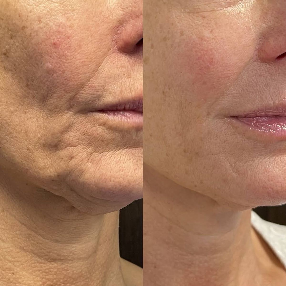 Anti-aging serum stick with bee venom and triple peptide complex, 30ml firming formula