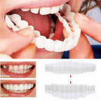 Clip-on veneers upper and lower set snap-on smile cover for stained or crooked teeth