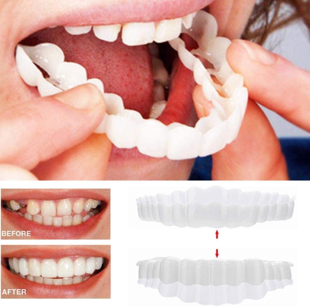 Clip-on veneers upper and lower set snap-on smile cover for stained or crooked teeth
