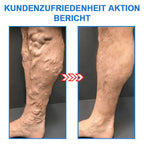 Compression socks with tourmaline ion technology for slimmer legs and firmer skin