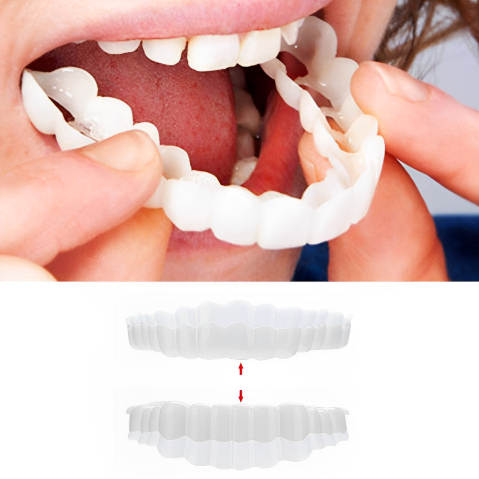 Clip-on veneers upper and lower set snap-on smile cover for stained or crooked teeth
