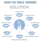 Clip-on veneers upper and lower set snap-on smile cover for stained or crooked teeth